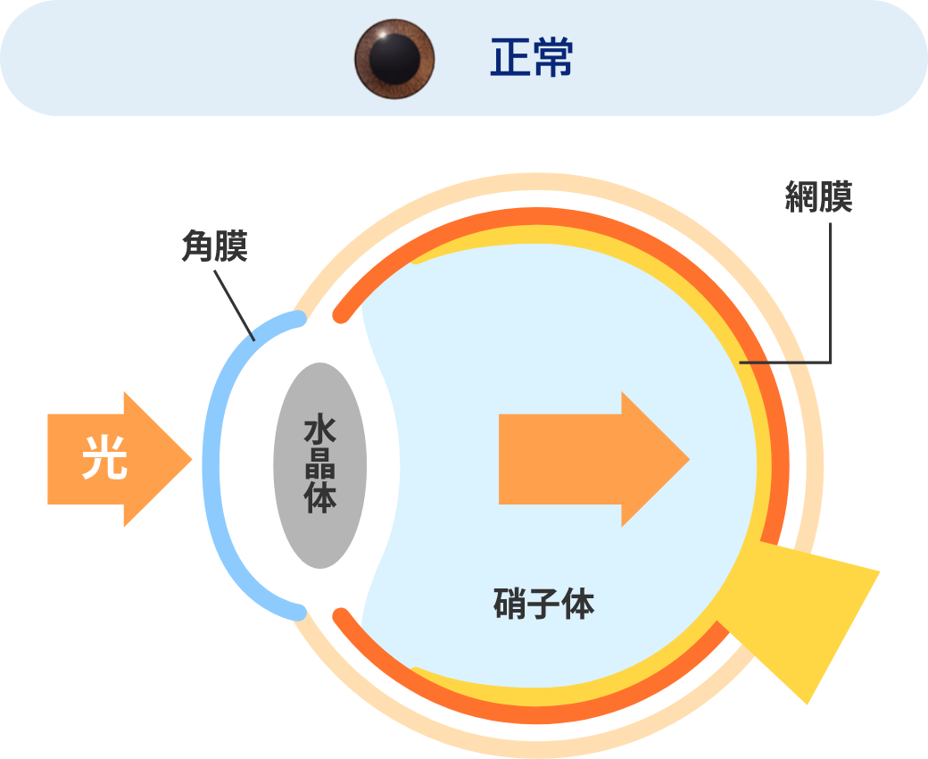 正常