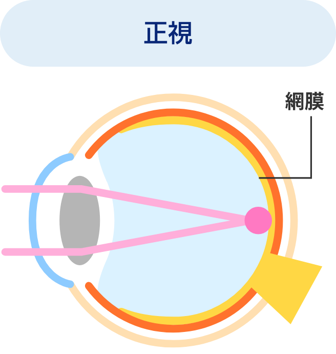 正規