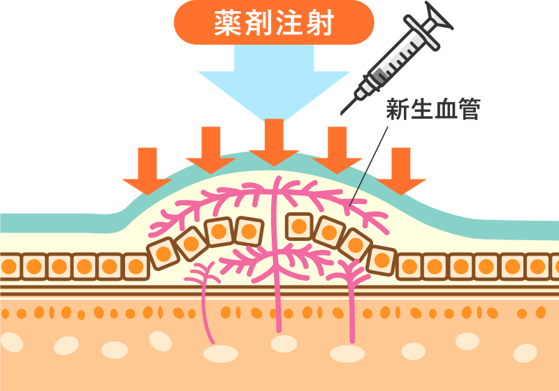 正常な状態