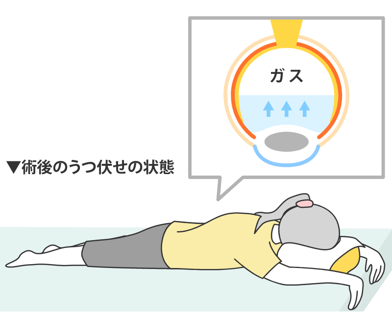 手術方法